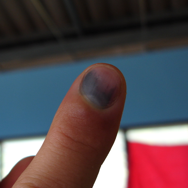Blackened Fingernail Smashed